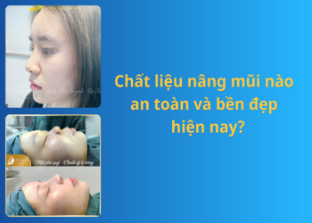 Chất liệu nâng mũi nào an toàn và hiệu quả cao nhất hiện nay?